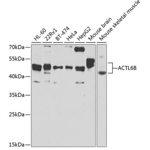 ACTL6B Rabbit pAb
