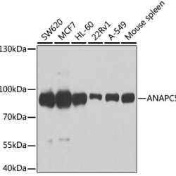 [KO Validated] ANAPC5 Rabbit pAb