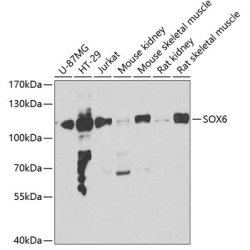 SOX6 Rabbit pAb