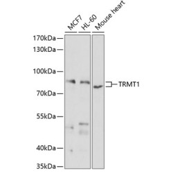 TRMT1 Rabbit pAb
