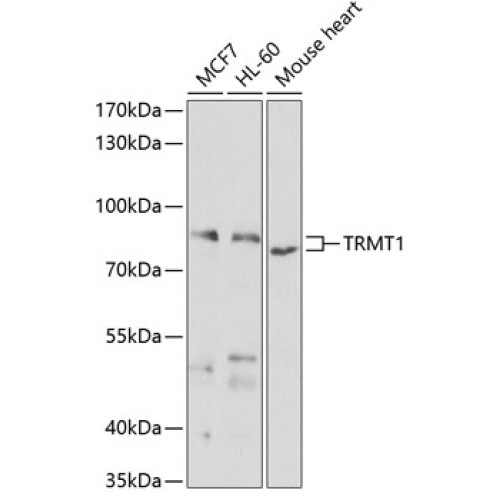 TRMT1 Rabbit pAb