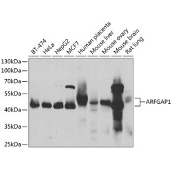 ARFGAP1 Rabbit pAb