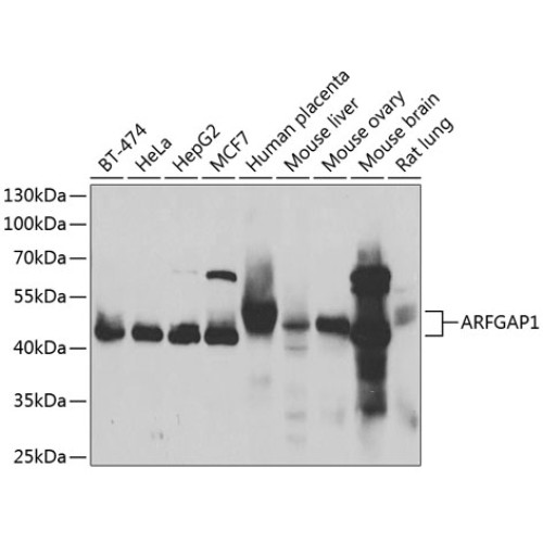 ARFGAP1 Rabbit pAb