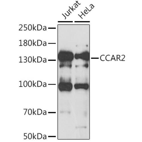 CCAR2 Rabbit pAb