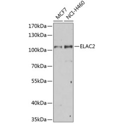 ELAC2 Rabbit pAb