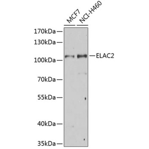 ELAC2 Rabbit pAb