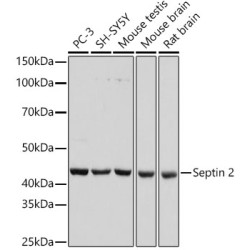 Septin 2 Rabbit mAb