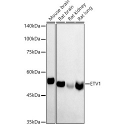 ETV1 Rabbit pAb