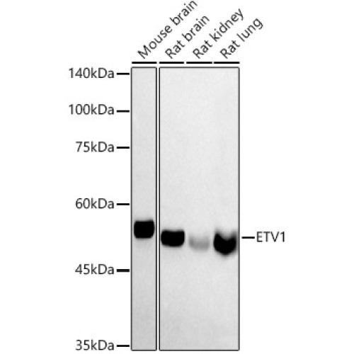 ETV1 Rabbit pAb