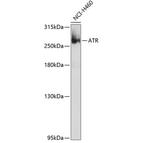 ATR Rabbit pAb