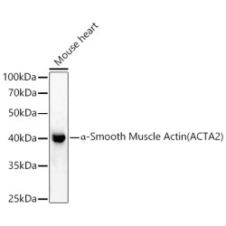 α-Smooth Muscle Actin (ACTA2) Rabbit pAb