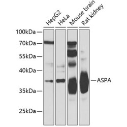 ASPA Rabbit pAb