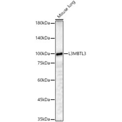 L3MBTL3 Rabbit pAb