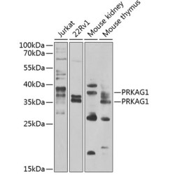 PRKAG1 Rabbit pAb