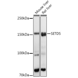 SETD5 Rabbit pAb