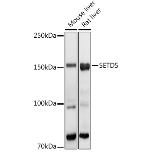SETD5 Rabbit pAb