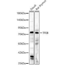 [KD Validated] TFEB Rabbit pAb