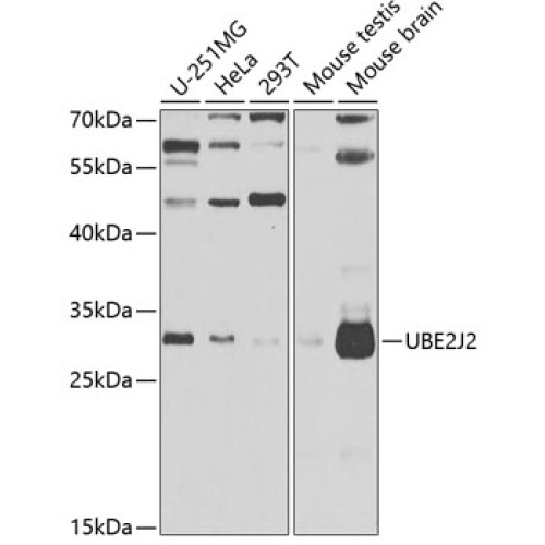 UBE2J2 Rabbit pAb