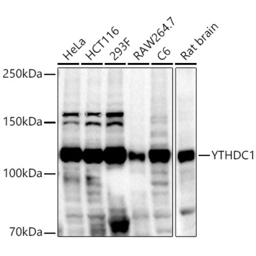 YTHDC1 Rabbit pAb