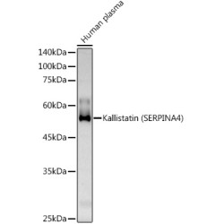 Kallistatin (SERPINA4) Rabbit pAb