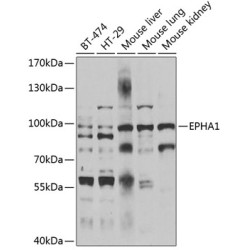 EPHA1 Rabbit pAb