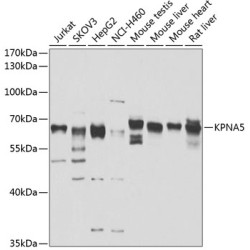 KPNA5 Rabbit pAb