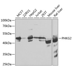 PHKG2 Rabbit pAb