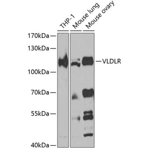 VLDLR Rabbit pAb