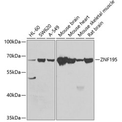 ZNF195 Rabbit pAb