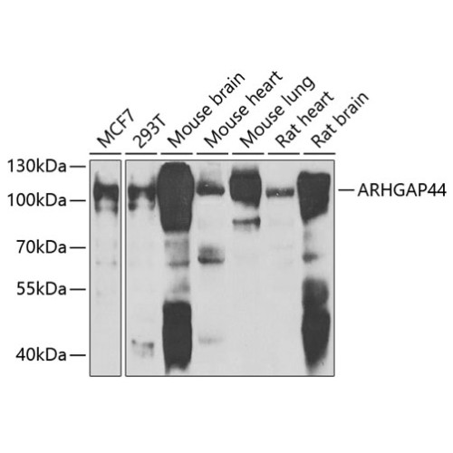 ARHGAP44 Rabbit pAb