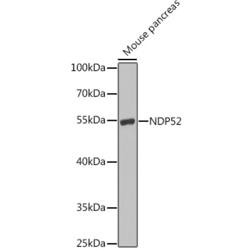 NDP52 Rabbit pAb