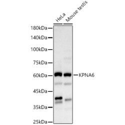 KPNA6 Rabbit pAb