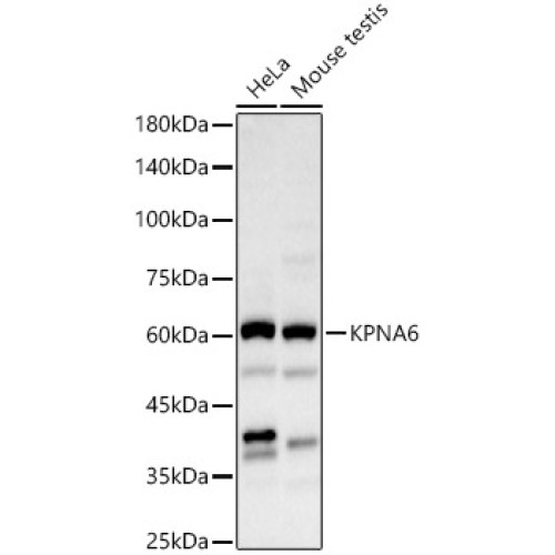 KPNA6 Rabbit pAb