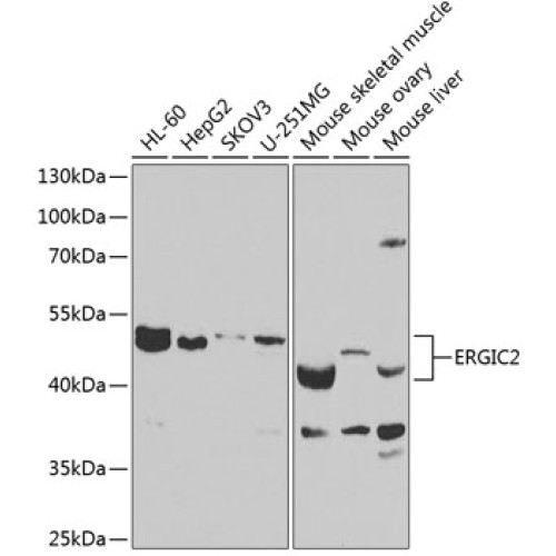 ERGIC2 Rabbit pAb
