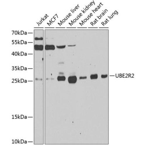UBE2R2 Rabbit pAb