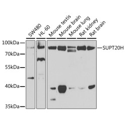 SUPT20H Rabbit pAb