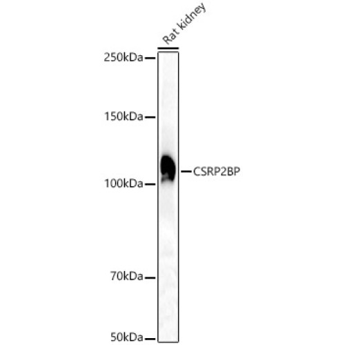 CSRP2BP Rabbit pAb