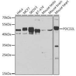 PDCD2L Rabbit pAb