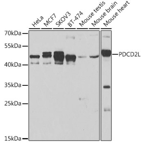 PDCD2L Rabbit pAb