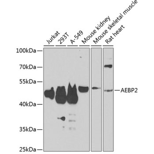 AEBP2 Rabbit pAb