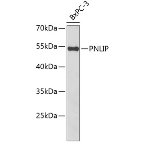 PNLIP Rabbit pAb
