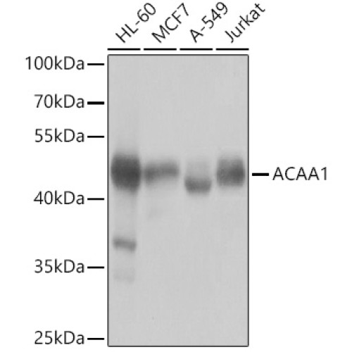ACAA1 Rabbit pAb