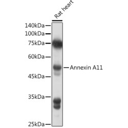 Annexin A11  Rabbit pAb