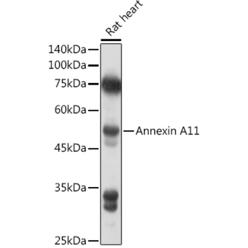 Annexin A11  Rabbit pAb