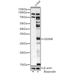 GSDME (Full length+N terminal)Rabbit pAb