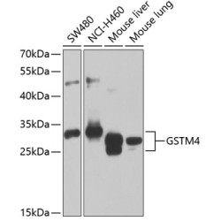 GSTM4 Rabbit pAb