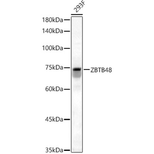 ZBTB48 Rabbit pAb
