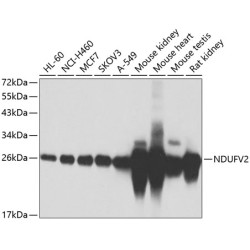 NDUFV2 Rabbit pAb