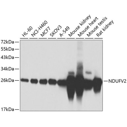 NDUFV2 Rabbit pAb