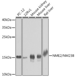 NME2/NM23B Rabbit pAb